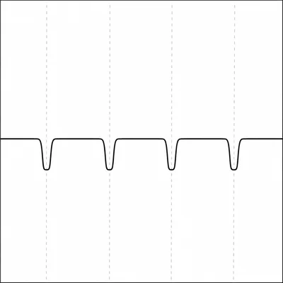 A light curve with four evenly spaced transit dips.