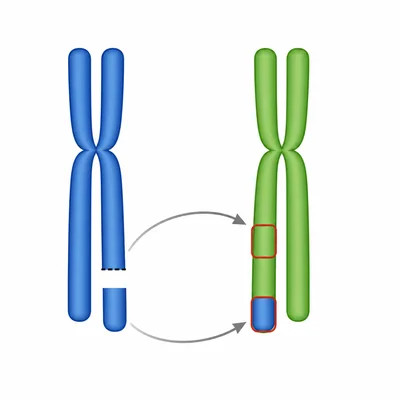 A chromosome segment breaks off and attaches to a different chromosome.