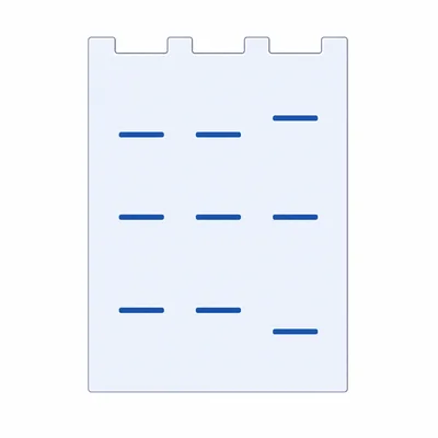 Three gel electrophoresis lanes, with two lanes matching exactly and one lane showing mismatched bands.