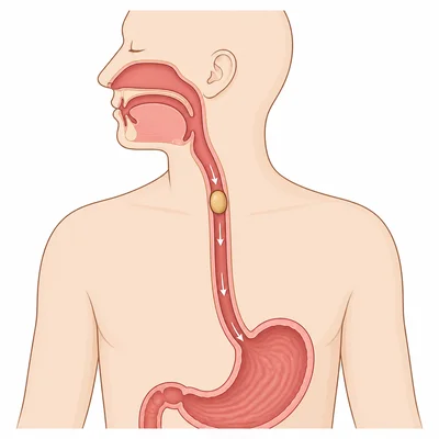 Food moving down the esophagus toward the stomach.